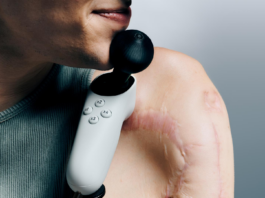 Xbox Introduces Four New Accessibility Features – Xbox Wire Adaptive Joystick Hero Image