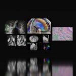 AI and Federated Learning Enhance Cancer Detection at Medical Centers medical imaging scans