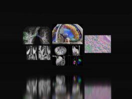 AI and Federated Learning Enhance Cancer Detection at Medical Centers medical imaging scans