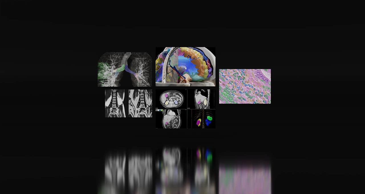 hc image medical imaging 2756600 1.jpg medical imaging scans