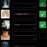 AI Model Identifies Diseases Through Cough Analysis This AI model is helping researchers detect disease based on coughs
