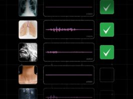 AI Model Identifies Diseases Through Cough Analysis This AI model is helping researchers detect disease based on coughs
