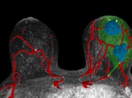 AI-Driven 3D Models Aid Surgeons in Locating Breast Cancer Startup Helps Surgeons Target Breast Cancers With AI-Powered 3D Visualizations